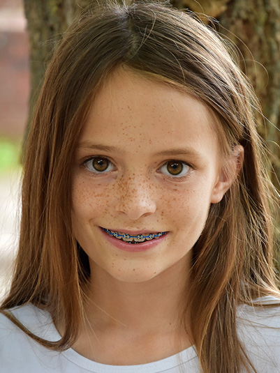 early orthodontic treatment